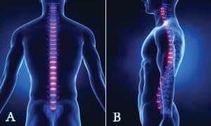 spinal cord