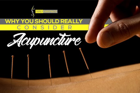 Why You Should Really Consider Acupuncture