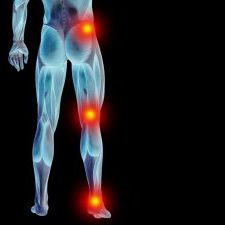 Pain that extends from your lower spine to your buttock and down the back of your leg